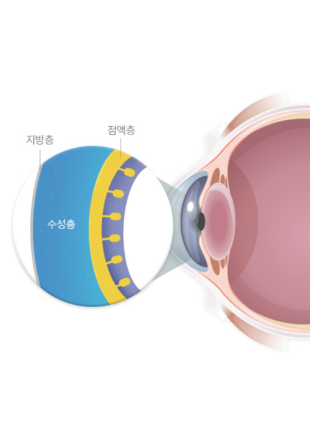 서울연세안과의원 안구건조증